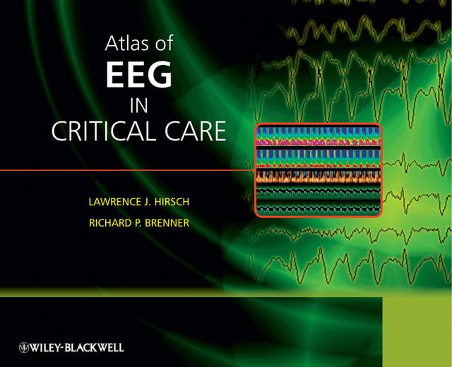 Atlas of EEG in Critical Care by Lawrence J. Hirsch, Richard P. Brenner