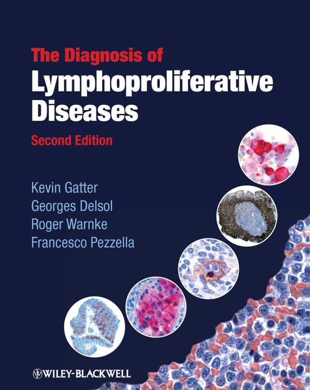 The Diagnosis of Lymphoproliferative Diseases by Francesco Pezzella, Georges Delsol, Kevin Gatter, Roger Warnke