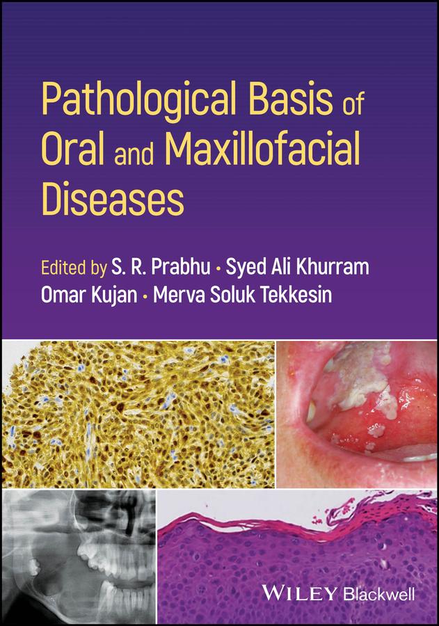 Pathological Basis of Oral and Maxillofacial Diseases by Merva Soluk Tekkesin, Omar Kujan, S. R. Prabhu, Syed Ali Khurram