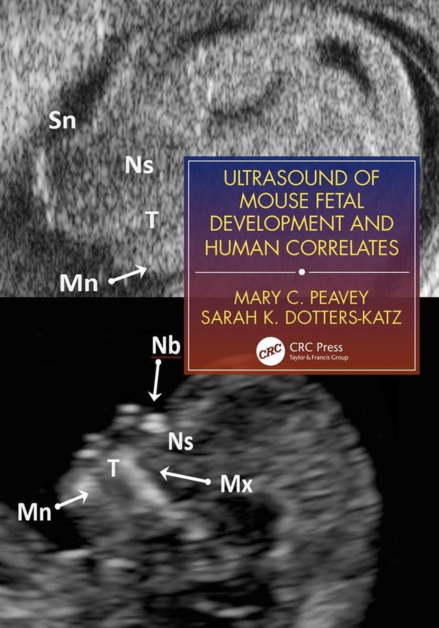 Ultrasound of Mouse Fetal Development and Human Correlates by Mary C. Peavey, Sarah K. Dotters-Katz