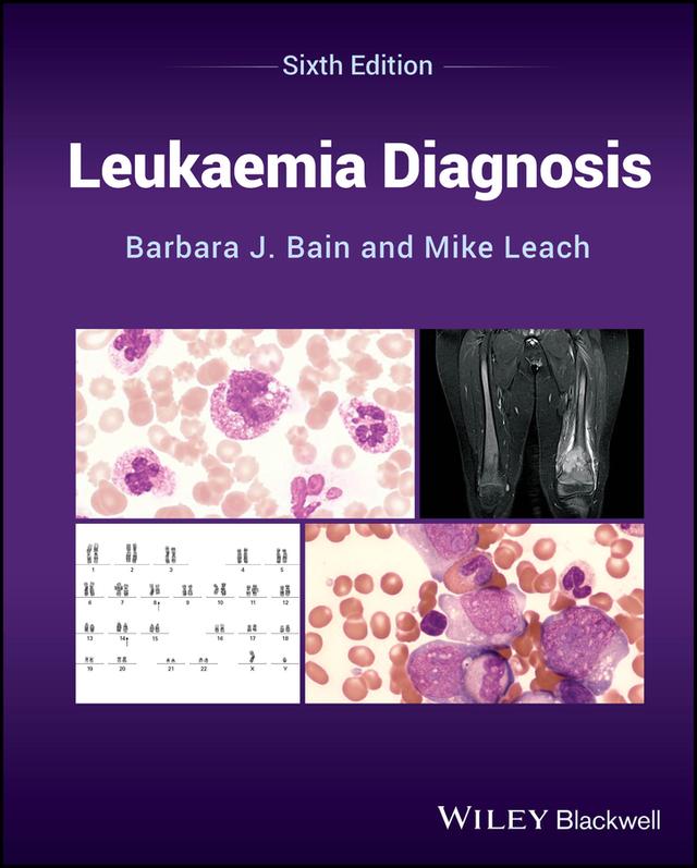 Leukaemia Diagnosis by Barbara J. Bain, Mike Leach