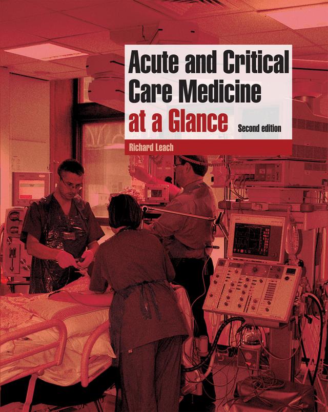 Acute and Critical Care Medicine at a Glance by Richard M. Leach