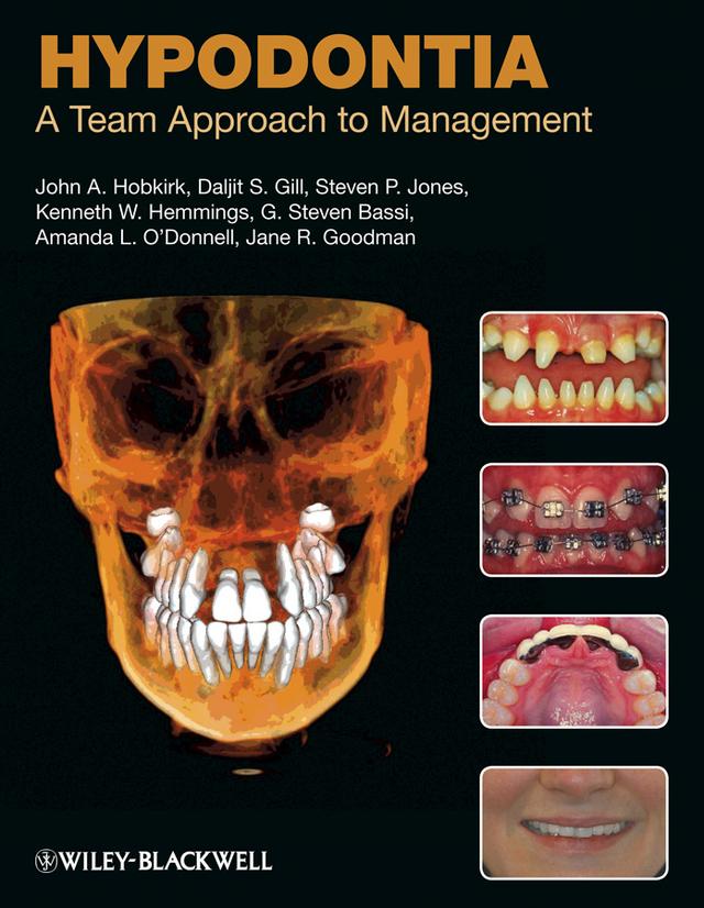 Hypodontia by Amanda L. O'Donnell, Daljit S. Gill, G. Steven Bassi, Jane R. Goodman, John A. Hobkirk, Kenneth W. Hemmings, Steven P. Jones