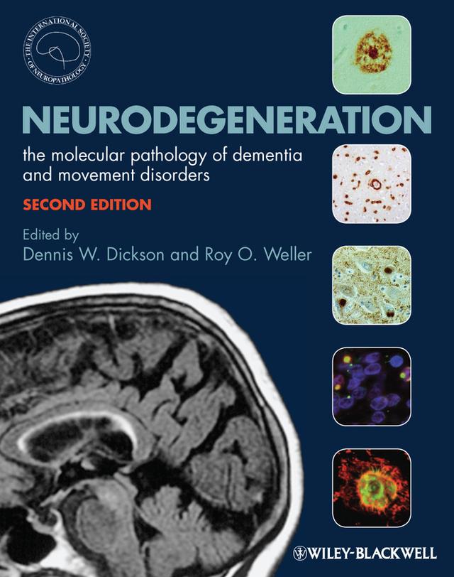Neurodegeneration by Dennis Dickson, Roy O. Weller