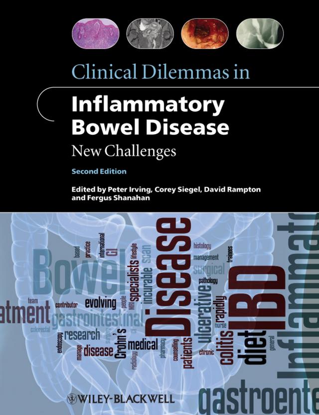 Clinical Dilemmas in Inflammatory Bowel Disease by Corey A. Siegel, David Rampton, Fergus Shanahan, Peter Irving, MD, MRCP