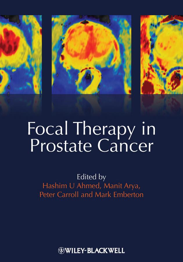 Focal Therapy in Prostate Cancer by Hashim Uddin Ahmed, Manit Arya, Mark Emberton, Peter R. Carroll