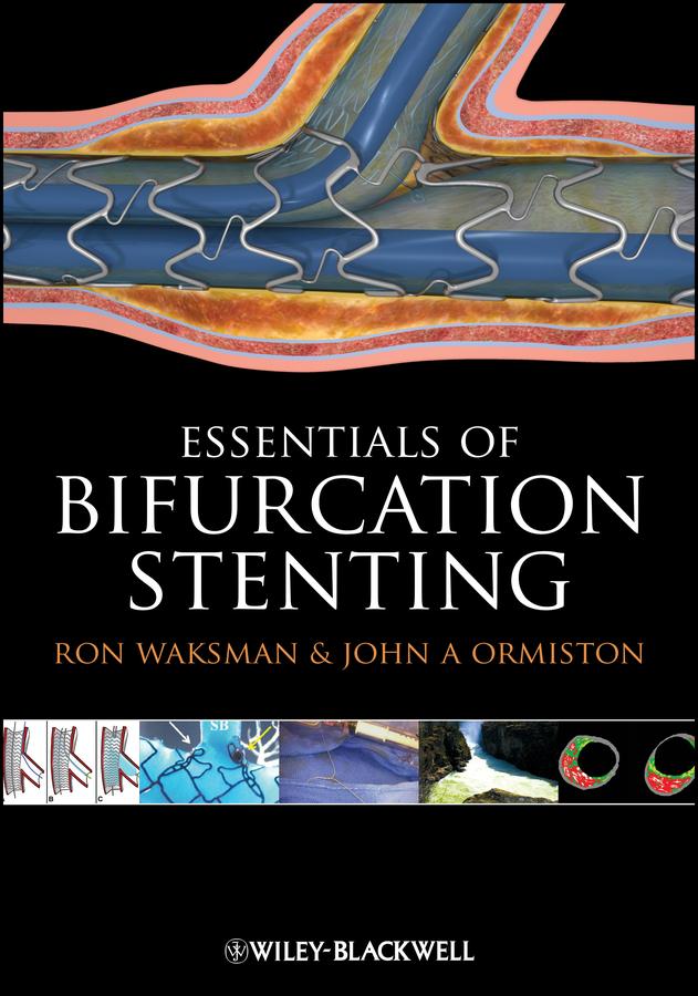 Bifurcation Stenting by John A. Ormiston, Ron Waksman
