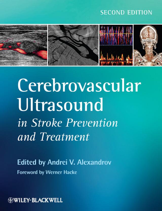 Cerebrovascular Ultrasound in Stroke Prevention and Treatment by Andrei V. Alexandrov, Werner Hacke