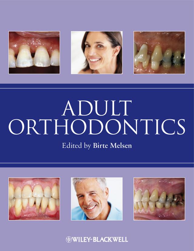 Adult Orthodontics by Birte Melsen