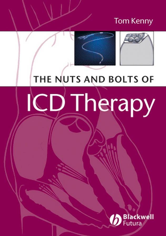 The Nuts and Bolts of ICD Therapy by Tom Kenny
