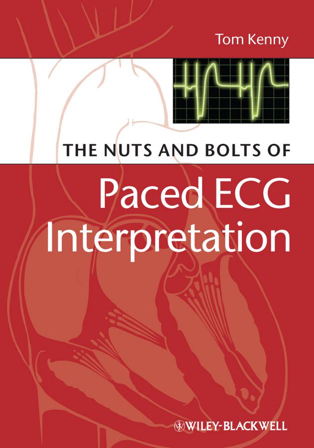 The Nuts and bolts of Paced ECG Interpretation by Tom Kenny