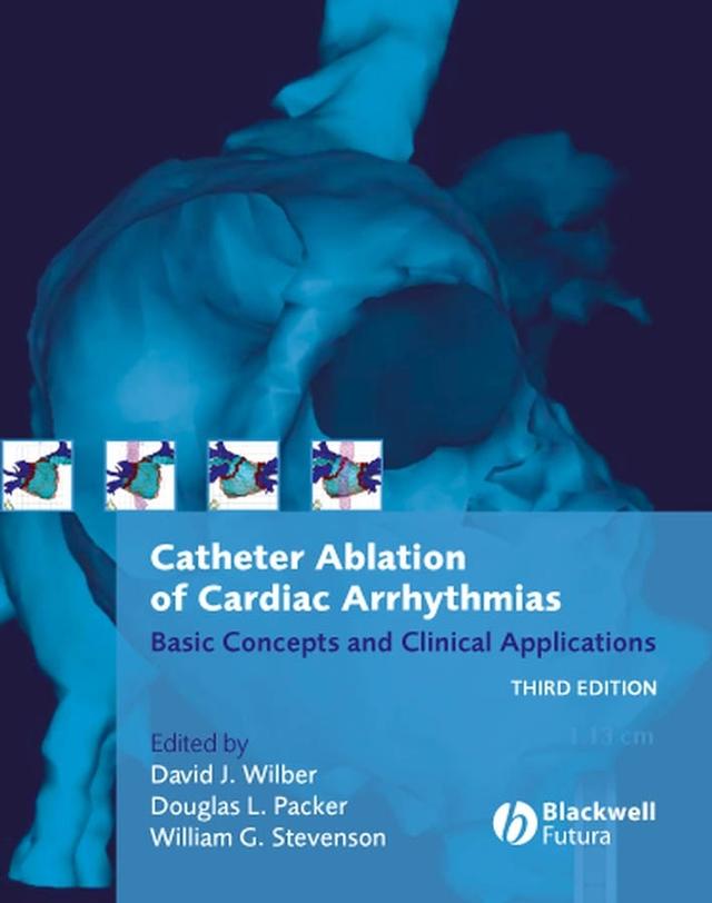 Catheter Ablation of Cardiac Arrhythmias by David J. Wilber, Douglas L. Packer, William G. Stevenson