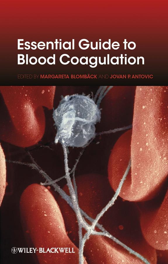 Essential Guide to Blood Coagulation by Jovan P. Antovic, Margareta Blombäck