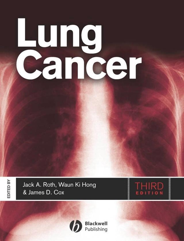 Lung Cancer by Jack A. Roth, James D. Cox, Waun Ki Hong