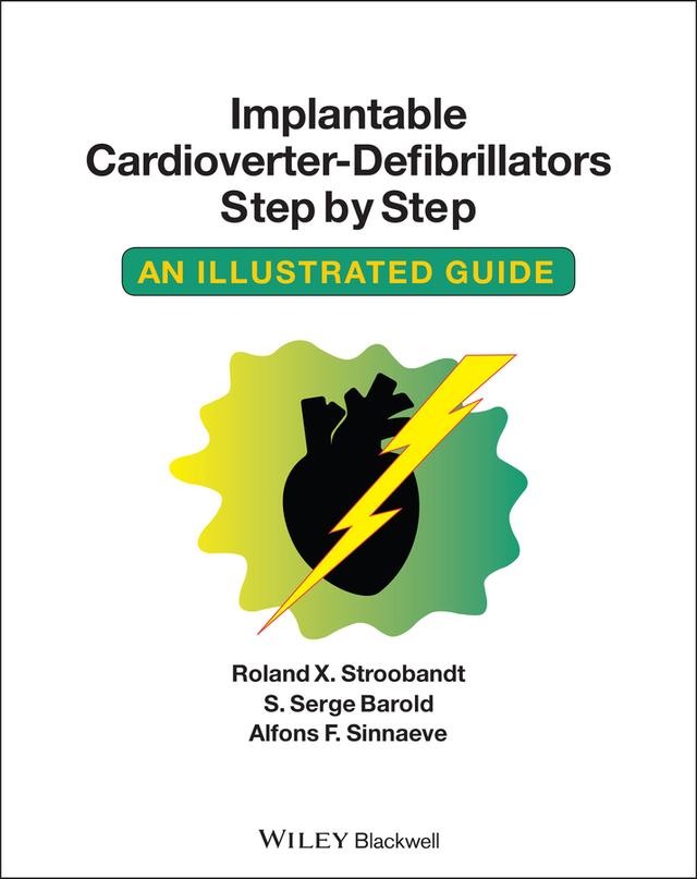Implantable Cardioverter - Defibrillators Step by Step by Alfons F. Sinnaeve, Roland X. Stroobandt, S. Serge Barold