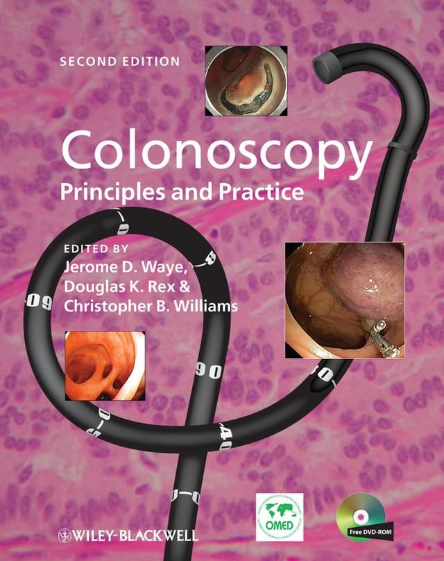 Colonoscopy by Christopher B. Williams, Douglas K. Rex, Jerome D. Waye