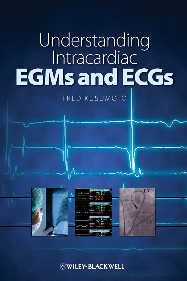 Understanding Intracardiac EGMs and ECGs by Fred M. Kusumoto