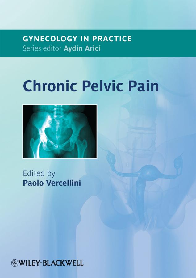Chronic Pelvic Pain by Paolo Vercellini