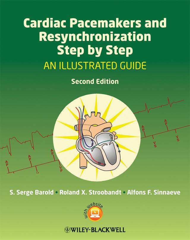 Cardiac Pacemakers and Resynchronization Step by Step by Alfons F. Sinnaeve, Roland X. Stroobandt, S. Serge Barold