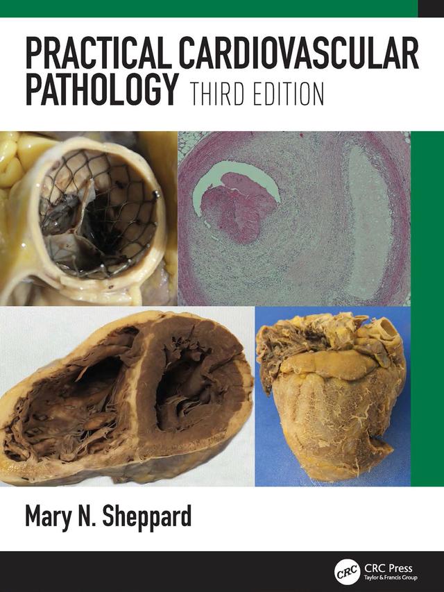 Practical Cardiovascular Pathology by Mary N. Sheppard