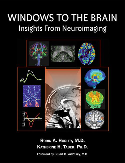 Windows to the Brain by Katherine H. Taber, Robin A. Hurley
