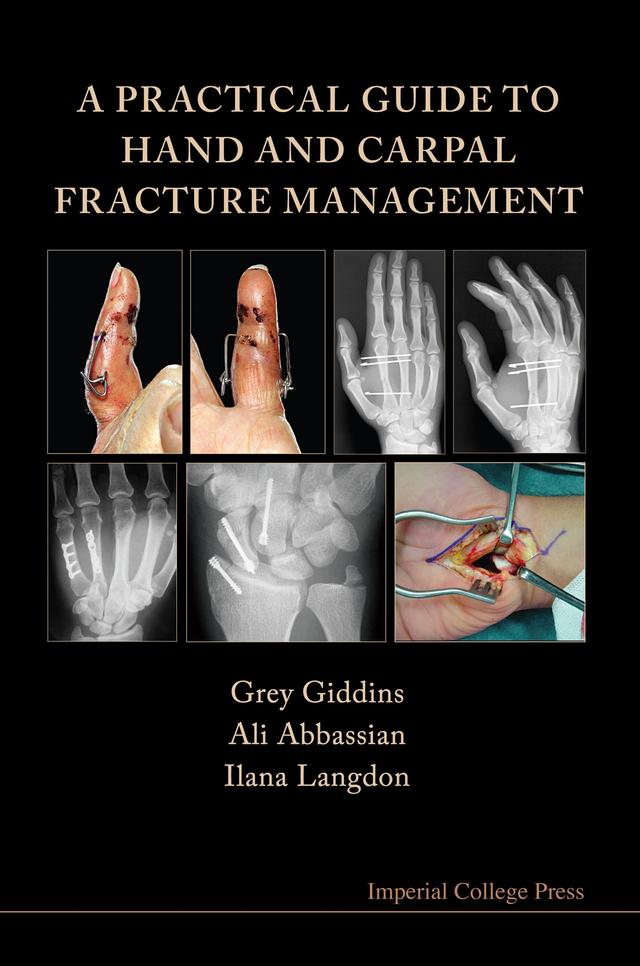 PRACTICAL GUIDE TO HAND & CARPAL FRAC, A by Ali Abbassian, Grey Giddins, Ilana Langdon