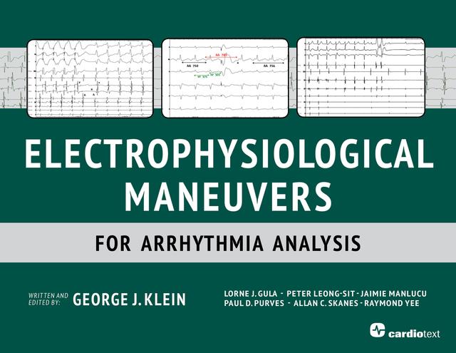 Electrophysiological Maneuvers for Arrhythmia Analysis by George Klein, Lorne Gula, Peter Leong-Sit