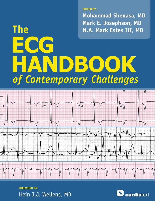 The ECG Handbook of Contemporary Challenges by Mark Josephson, Mohammad Shenasa, N.A. Mark Estes