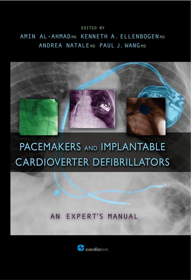 Pacemakers and Implantable Cardioverter Defibrillators: An Expert's Manual by Amin Al-Ahmad, Andrea Natale, Kenneth Ellenbogen