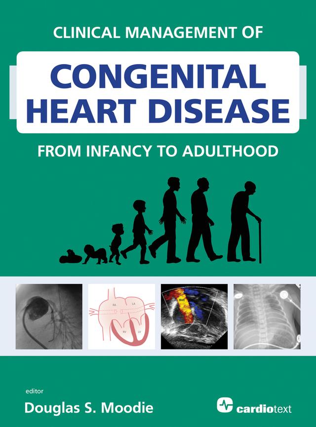 Clinical Management of Congenital Heart Disease from Infancy to Adulthood by Douglas Moodie