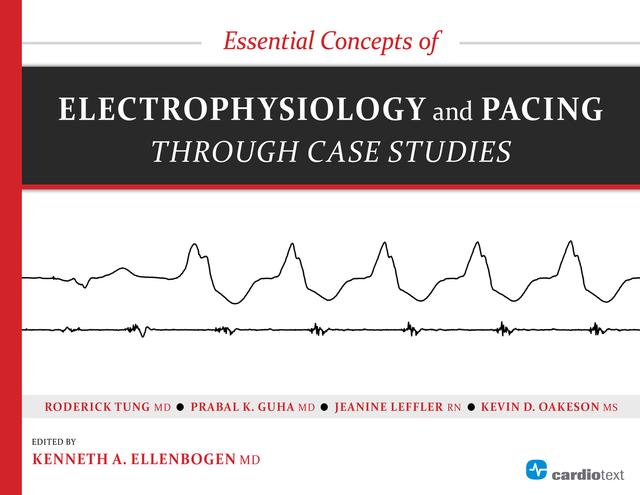 Essential Concepts of Electrophysiology and Pacing through Case Studies by Kenneth Ellenbogen, Prabal Guha, Roderick Tung
