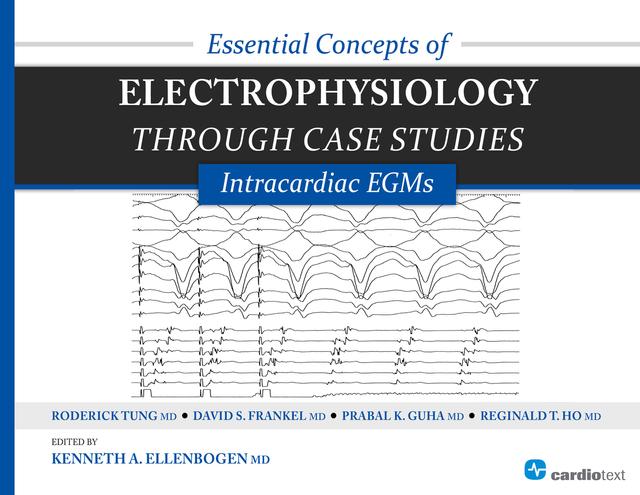 Essential Concepts of Electrophysiology through Case Studies: Intracardiac EGMs by David Frankel, Kenneth Ellenbogen, Roderick Tung