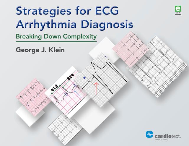 Strategies for ECG Arrhythmia Diagnosis by George J. Klein, Lorne J. Gula, Peter Leong-Sit