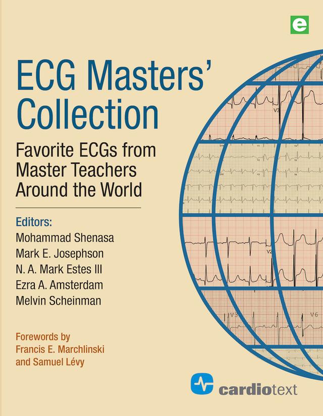 ECG Masters Collection by Ezra A. Amsterdam, Mark E. Josephson, Melvin Scheinman, Mohammad Shenasa, N.A. Mark Estes
