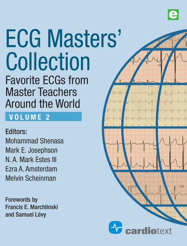 ECG Masters Collection Volume 2 by Ezra A. Amsterdam, Mark E. Josephson, Melvin Scheinman, Mohammad Shenasa, N.A. Mark Estes III