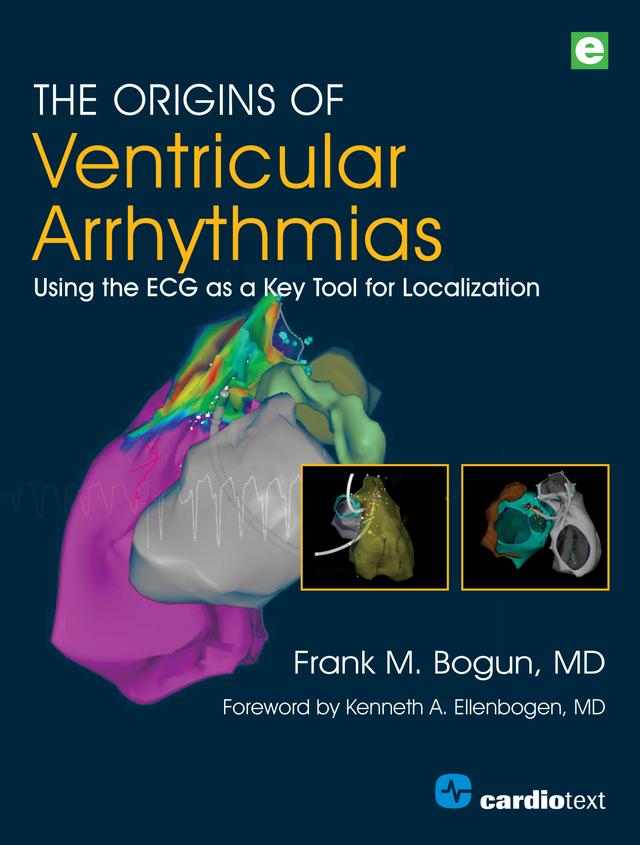 The Origins of Ventricular Arrhythmias by Frank M. Bogun MD