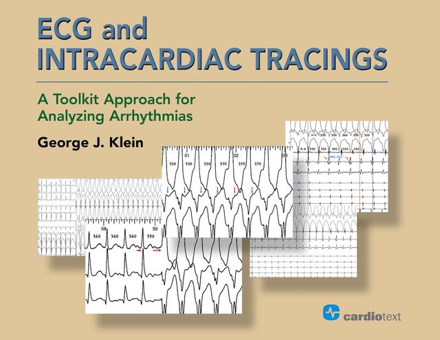 ECG and Intracardiac Tracings by George J. Klein