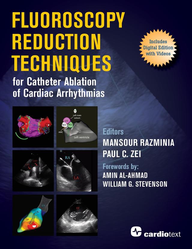 Fluoroscopy Reduction Techniques for Catheter Ablation of Cardiac Arrhythmias by Mansour Razminia, Paul C. Zei