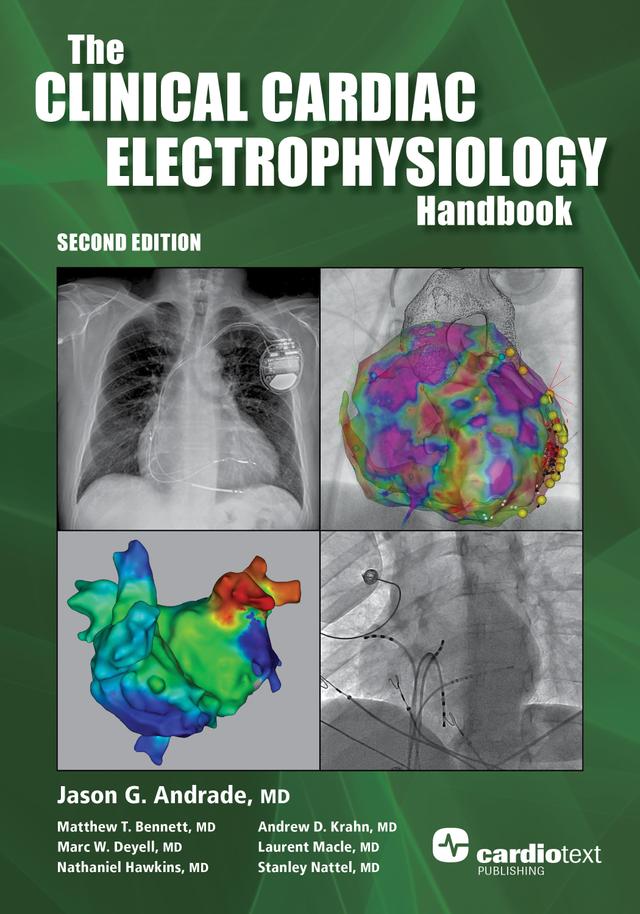 Clinical Cardiac Electrophysiology Handbook, Second Edition by Jason Andrade