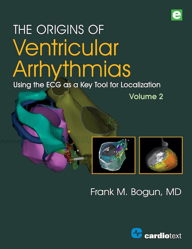 The Origins of Ventricular Arrhythmias, Volume 2 by Frank M. Bogun