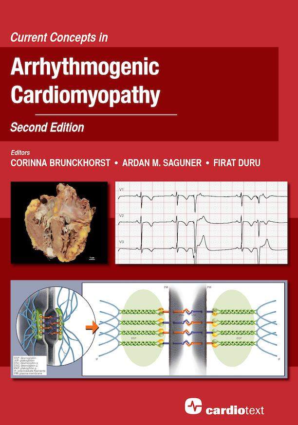 Current Concepts in Arrhythmogenic Cardiomyopathy, Second Edition by PD Dr. Ardan Saguner, Prof. Dr. Corrinna Brunckhorst, Prof. Dr. Firat Duru