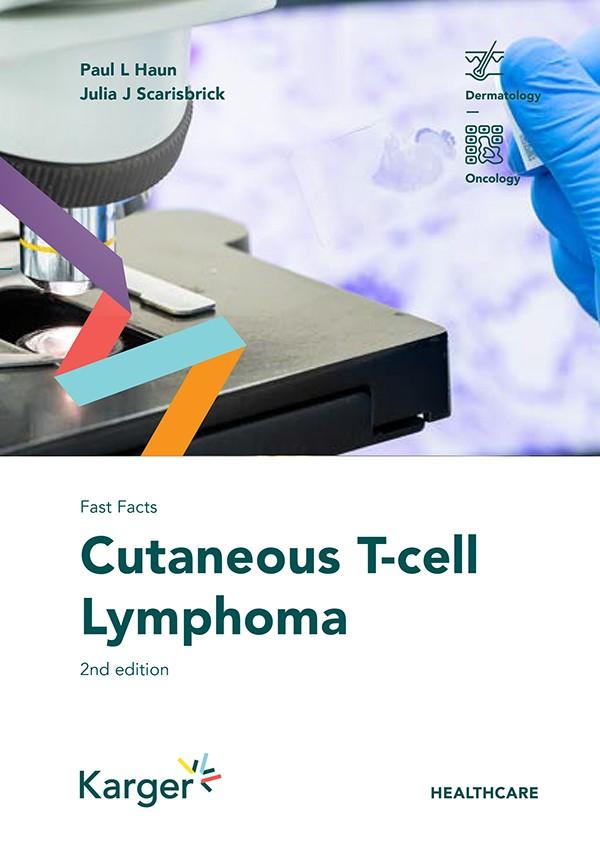 Fast Facts: Cutaneous T-cell Lymphoma by Julia J. Scarisbrick, Paul L. Haun