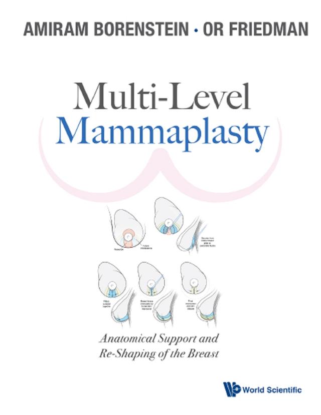 MULTI-LEVEL MAMMAPLASTY by Amiram Borenstein, Or Friedman