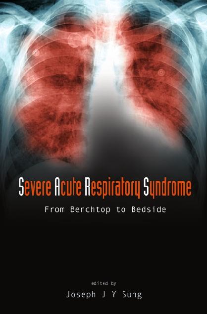 SEVERE ACUTE RESPIRATORY SYNDROME by Sung Joseph Jao Yiu
