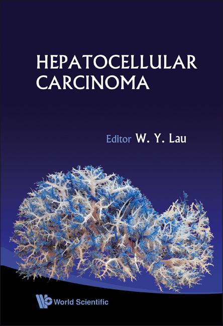 HEPATOCELLULAR CARCINOMA by Lau Joseph W Y