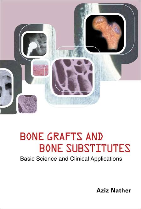 BONE GRAFTS & BONE SUBSTITUTES by Nather Abdul Aziz