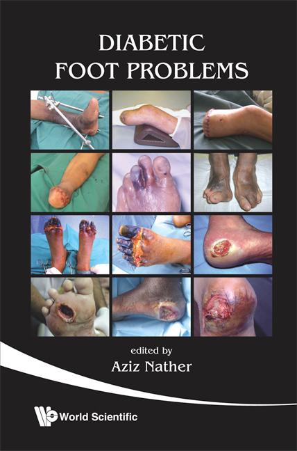 DIABETIC FOOT PROBLEMS by Aziz Nather