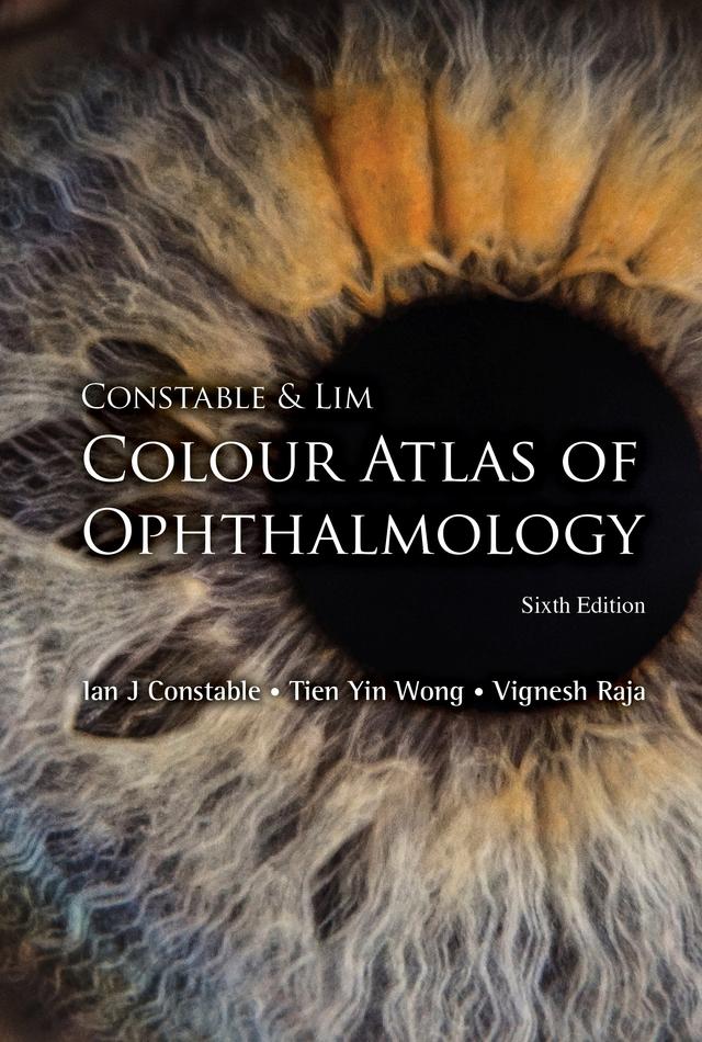 CONSTAB & LIM COLO ATLAS (6TH ED) by Ian J Constable, Tien Yin Wong, Vignesh Raja
