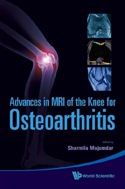 ADV IN MRI OF THE KNEE FOR OSTEOARTHRITI by Blumenfeld Janet, Krug Roland, Majumdar Sharmila