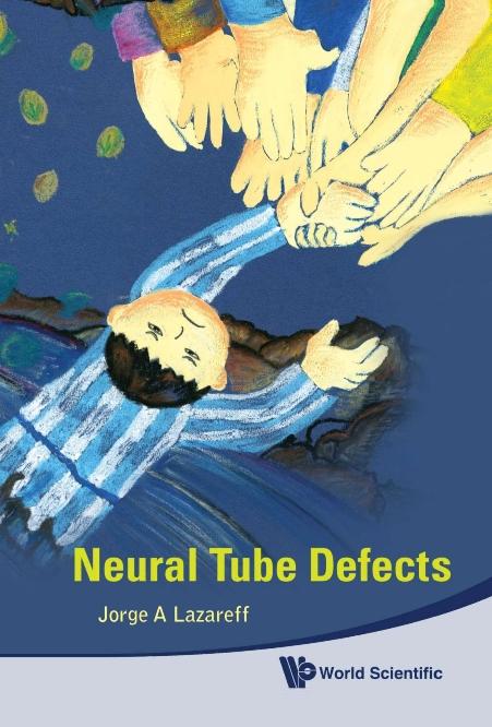 NEURAL TUBE DEFECTS by Lazareff Jorge A